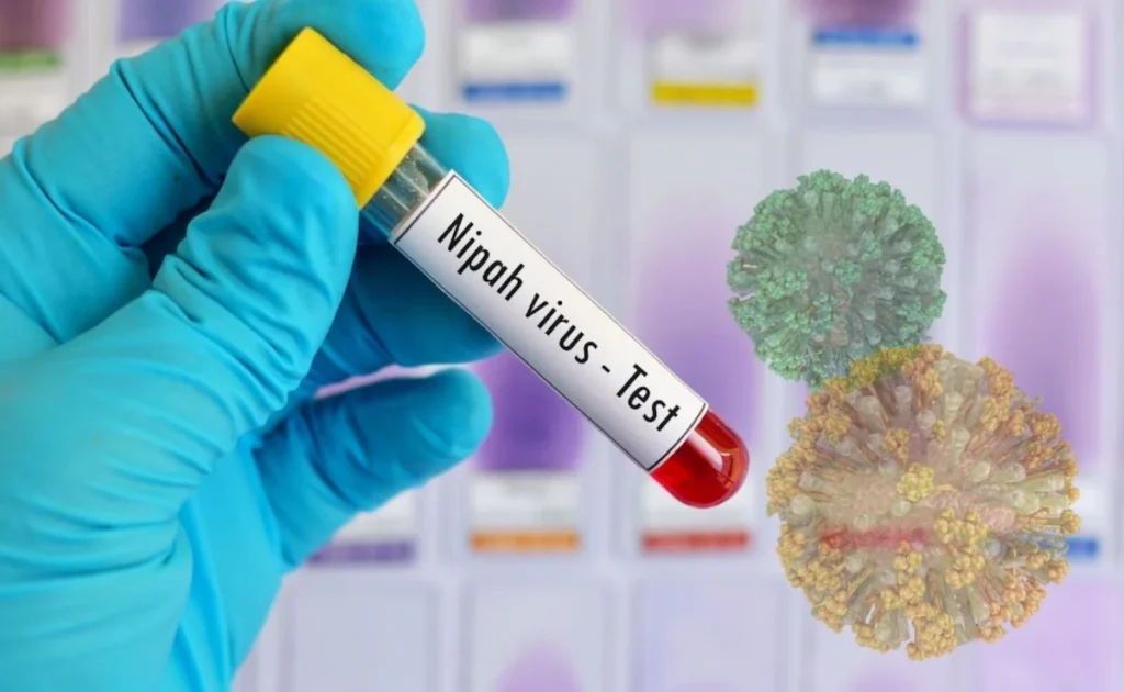 Nipah Virus