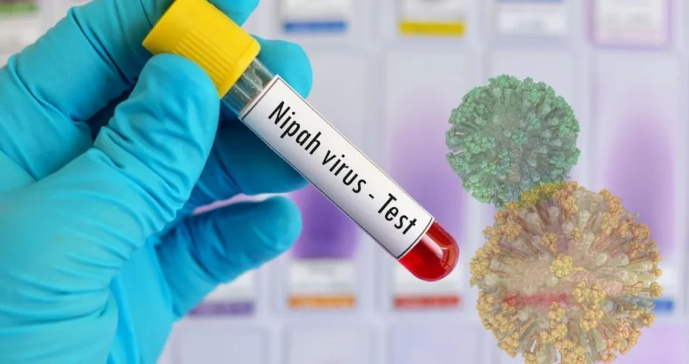 Nipah Virus