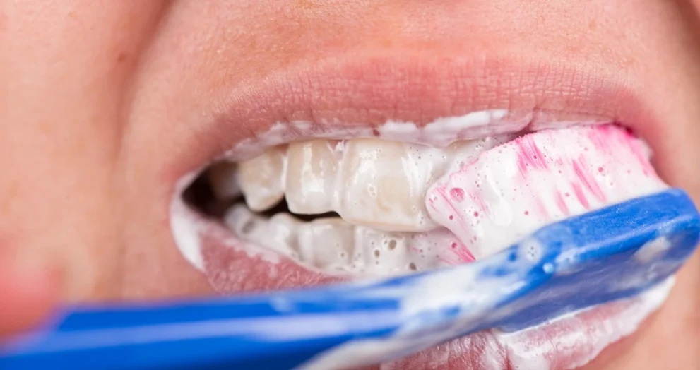 Teeth Turning Yellow Despite Brushing Causes and Solutions