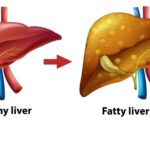 Poor Oral Hygiene and Heart Disease Risk: What Experts Say